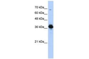 Image no. 1 for anti-ATPase, H+ Transporting, Lysosomal 38kDa, V0 Subunit D2 (ATP6V0D2) (AA 251-300) antibody (ABIN6743840)