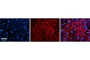 Rabbit Anti-S100A8 Antibody Catalog Number: ARP61367_P050 Formalin Fixed Paraffin Embedded Tissue: Human heart Tissue Observed Staining: Secreted Primary Antibody Concentration: 1:100 Other Working Concentrations: 1:600 Secondary Antibody: Donkey anti-Rabbit-Cy3 Secondary Antibody Concentration: 1:200 Magnification: 20X Exposure Time: 0. (S100A8 anticorps  (Middle Region))