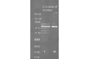 Goat anti Cholesterol oxidase antibody ( was used to detect purified cholesterol oxidase under reducing (R) and non-reducing (NR) conditions. (Cholesterol Oxidase anticorps  (Biotin))