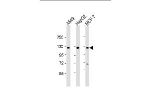 All lanes : Anti-KLB Antibody (N-Term) at 1:2000 dilution Lane 1: A549 whole cell lysate Lane 2: HepG2 whole cell lysate Lane 3: MCF-7 whole cell lysate Lysates/proteins at 20 μg per lane. (Klotho beta anticorps  (AA 1-29))