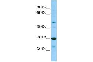 Host: Rabbit Target Name: SIRPB2 Sample Type: 721_B Whole Cell lysates Antibody Dilution: 1. (SIRPb2 anticorps  (C-Term))