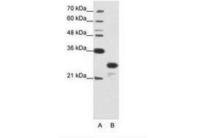 Image no. 2 for anti-Acidic (Leucine-Rich) Nuclear phosphoprotein 32 Family, Member A (ANP32A) (N-Term) antibody (ABIN202122) (PHAP1 anticorps  (N-Term))