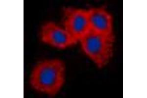 Immunofluorescent analysis of Vimentin staining in A549 cells. (Vimentin anticorps  (N-Term))