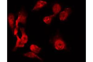 ABIN6267228 staining 293 by IF/ICC.