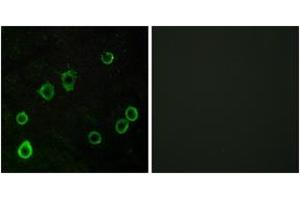 Immunofluorescence analysis of LOVO cells, using ADORA2A Antibody.