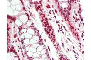 Human, Colon: Formalin-Fixed Paraffin-Embedded (FFPE).