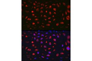 Immunofluorescence analysis of Rat cartilage using MGP Rabbit pAb (ABIN6128268, ABIN6143825, ABIN6143826 and ABIN6221090) at dilution of 1:100 (40x lens).