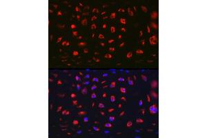 Immunofluorescence analysis of Rat cartilage using MGP Rabbit pAb (ABIN6128268, ABIN6143825, ABIN6143826 and ABIN6221090) at dilution of 1:100 (40x lens). (MGP anticorps  (AA 20-103))