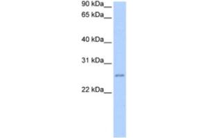 Western Blotting (WB) image for anti-Chromosome 8 Open Reading Frame 84 (C8orf84) antibody (ABIN2463542) (RPESP anticorps)