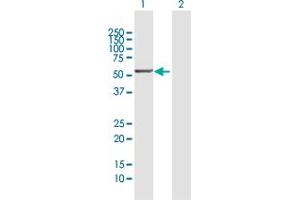 Western Blot analysis of PTGIS expression in transfected 293T cell line by PTGIS MaxPab polyclonal antibody.