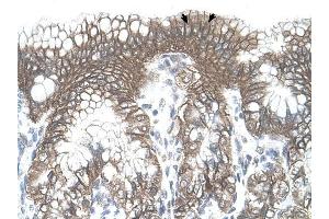 TARS antibody was used for immunohistochemistry at a concentration of 4-8 ug/ml to stain Epithelial cells of fundic gland (arrows) in Human Stomach.
