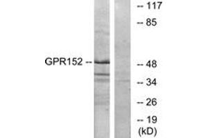 Western blot analysis of extracts from Jurkat cells, using GPR152 Antibody.
