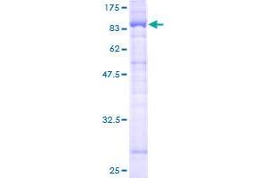 Image no. 1 for Leucine-rich repeat protein SHOC-2 (SHOC2) (AA 1-582) protein (GST tag) (ABIN1319958)