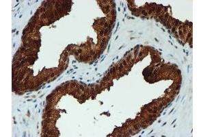 Image no. 8 for anti-Proteasome Subunit alpha 6 (PSMA6) antibody (ABIN1500464)