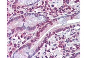 Anti-ABCC8 antibody IHC of human small intestine.