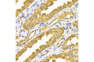Immunohistochemistry of paraffin-embedded Human kidney using PRKAA1 antibody at dilution of 1:100 (x400 lens).