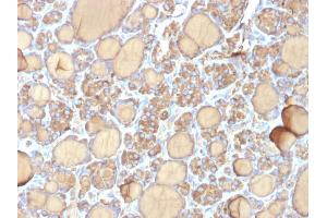 Formalin-fixed, paraffin-embedded human Thyroid stained with Thyroglobulin Mouse Recombinant Monoclonal Antibody (r6E1).