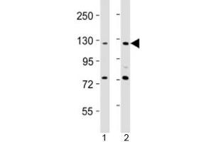 Western blot testing of AATK antibody at 1:2000 dilution. (AATK anticorps  (AA 55-90))
