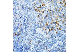Immunohistochemistry of paraffin-embedded mouse spleen using STING antibody (ABIN7270958) at dilution of 1:25 (40x lens).