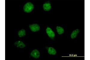 Immunofluorescence of purified MaxPab antibody to PFKFB3 on HeLa cell. (PFKFB3 anticorps  (AA 1-520))