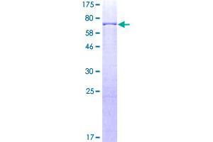 Image no. 1 for Transcription Factor AP-2 alpha (Activating Enhancer Binding Protein 2 Alpha) (TFAP2A) (AA 1-437) protein (GST tag) (ABIN1322521)