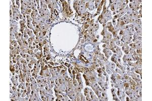 IHC analysis of Alanine Transaminase/Gpt using anti-Alanine Transaminase/Gpt antibody (ABIN7600506). (ALT anticorps  (AA 2-496))