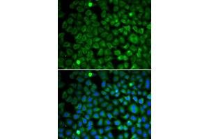 Immunofluorescence analysis of U2OS cells using NUP62 antibody (ABIN5971334). (NUP62 anticorps)