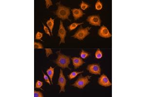 Immunofluorescence analysis of L929 cells using Rig-I/DDX58 antibody (ABIN6130263, ABIN6139513, ABIN6139515 and ABIN6217394) at dilution of 1:100. (DDX58 anticorps  (AA 726-925))