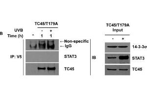 14-3-3σ transports TC45 into the keratinocyte nucleus following UVB irradiation through direct binding3PC keratinocytes overexpressing A.