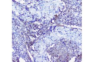 IHC analysis of Lumican using anti-Lumican antibody (ABIN6719339).