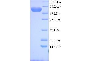 SDS-PAGE (SDS) image for Myosin Regulatory Light Chain Interacting Protein (MYLIP) (AA 1-445), (full length) protein (His tag) (ABIN5714446)