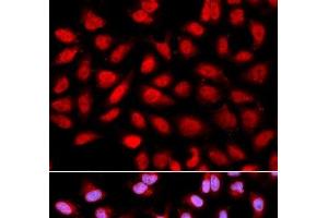 Immunofluorescence analysis of U2OS cells using PPP2R4 Polyclonal Antibody