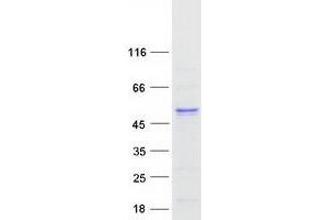 Validation with Western Blot