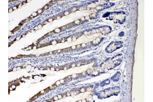 IHC analysis of Cytochrome P450 2D6 using anti- Cytochrome P450 2D6 antibody .