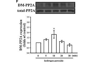 Role of ROS in the inhibitory effects of PMC in LPS/IFN-γ-stimulated VSMCs. (PPP2CA anticorps  (C-Term))