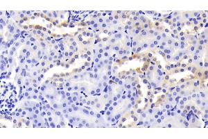 Detection of HOP in Mouse Kidney Tissue using Polyclonal Antibody to Homeodomain Only Protein (HOP) (HOPX anticorps  (AA 11-73))