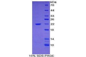 SDS-PAGE (SDS) image for Monoamine Oxidase A (MAOA) (AA 16-196) protein (His tag) (ABIN2121632)