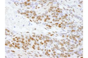 Immunohistochemistry (IHC) image for anti-DEAD (Asp-Glu-Ala-Asp) Box Polypeptide 5 (DDX5) (C-Term) antibody (ABIN7448522)