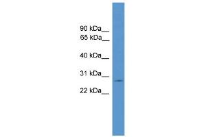 WB Suggested Anti-CLRN1 Antibody Titration: 0. (Clarin 1 anticorps  (C-Term))