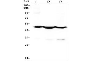 Western blot analysis of Cytokeratin 18 using anti-Cytokeratin 18 antibody (ABIN7600573). (Cytokeratin 18 anticorps  (AA 204-430))