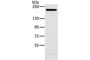Western Blot analysis of Hela cell using NCOA3 Polyclonal Antibody at dilution of 1:200 (NCOA3 anticorps)
