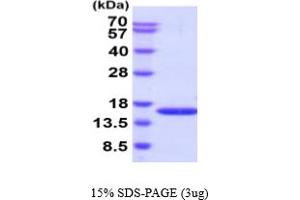 SDS-PAGE (SDS) image for phosphohistidine Phosphatase 1 (PHPT1) (AA 1-125) (Active) protein (His tag) (ABIN6388004) (PHPT1 Protein (AA 1-125) (His tag))