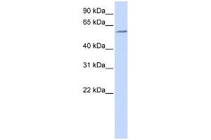 WB Suggested Anti-ZBTB7A Antibody Titration:  0. (ZBTB7A anticorps  (N-Term))