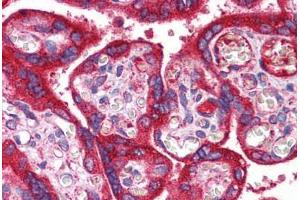 Human Placenta: Formalin-Fixed, Paraffin-Embedded (FFPE)