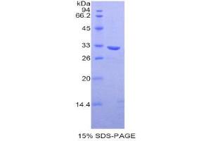 SDS-PAGE (SDS) image for Chloride Channel Accessory 1 (CLCA1) (AA 416-670) protein (His tag) (ABIN1877431)
