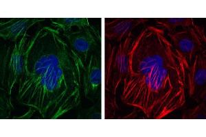 Immunofluorescence analysis of HepG2 cells using ACTA2 mouse mAb (green).