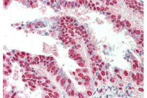 Rabbit Anti-IRX3 antibody  Formalin Fixed Paraffin Embedded Tissue: Human Uterus Primary antibody Concentration: 1:100 Secondary Antibody: Donkey anti-Rabbit-Cy3 Secondary Antibody Concentration: 1:200 Magnification: 20x Exposure Time: 0.