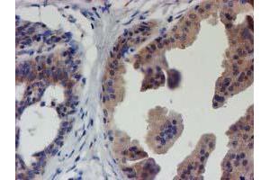 Immunohistochemical staining of paraffin-embedded Human breast tissue using anti-EIF4E2 mouse monoclonal antibody. (EIF4E2 anticorps)