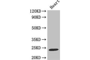 Western Blot Positive WB detected in: Mouse heart tissue All lanes: TIMP1 antibody at 2 μg/mL Secondary Goat polyclonal to rabbit IgG at 1/50000 dilution Predicted band size: 24 kDa Observed band size: 24 kDa (TIMP1 anticorps  (AA 24-207))