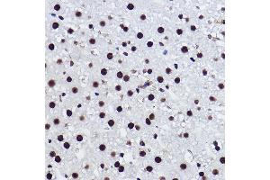 Immunohistochemistry of paraffin-embedded rat liver using BRMS1 Rabbit mAb (ABIN7265928) at dilution of 1:100 (40x lens).
